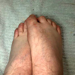 FootCrush photo