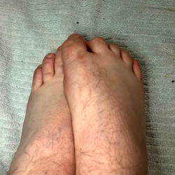 FootCrush photo