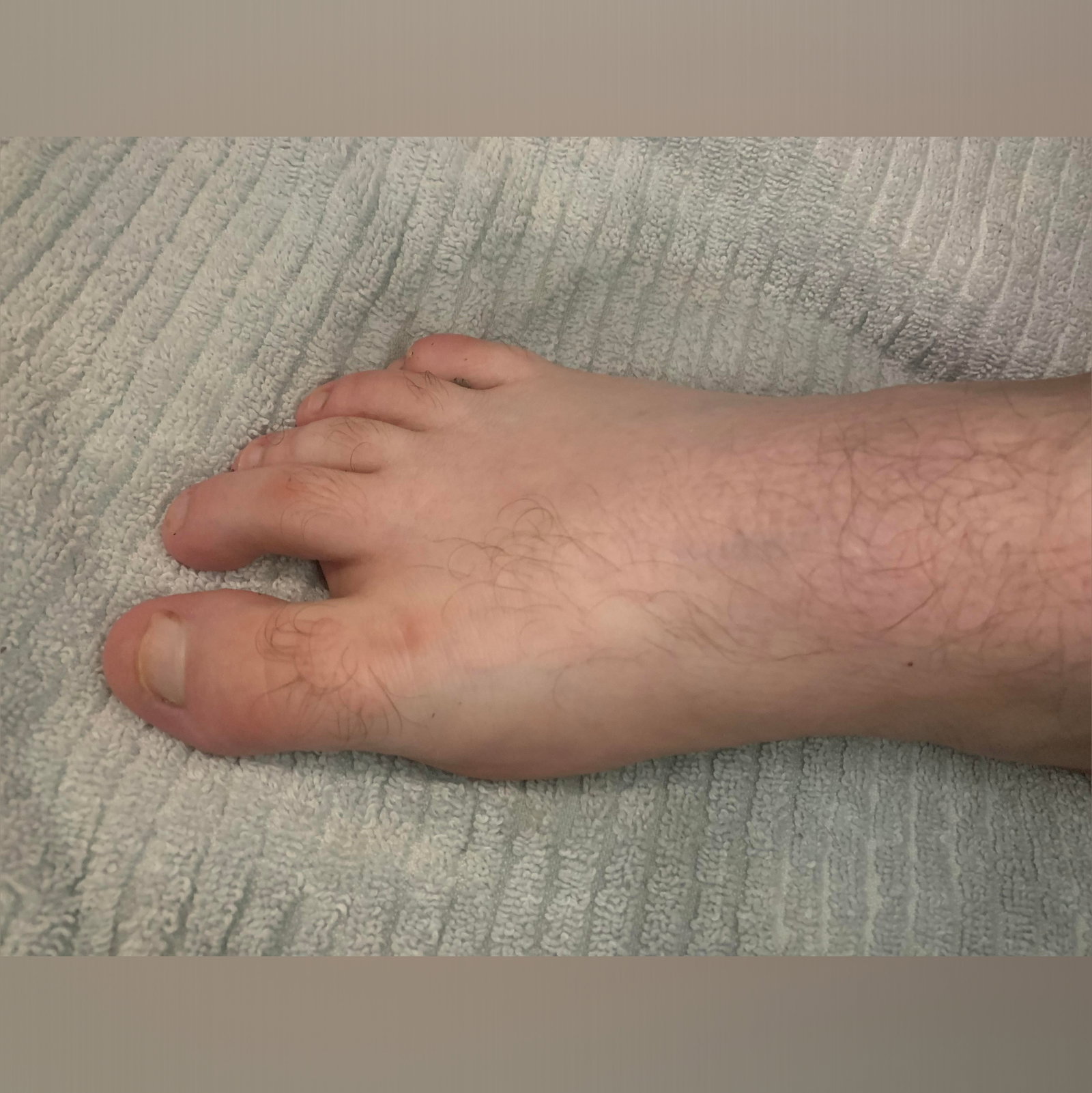 FootCrush photo