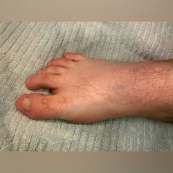 FootCrush photo