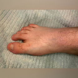 FootCrush photo