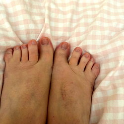 WebbedFeetRita photo